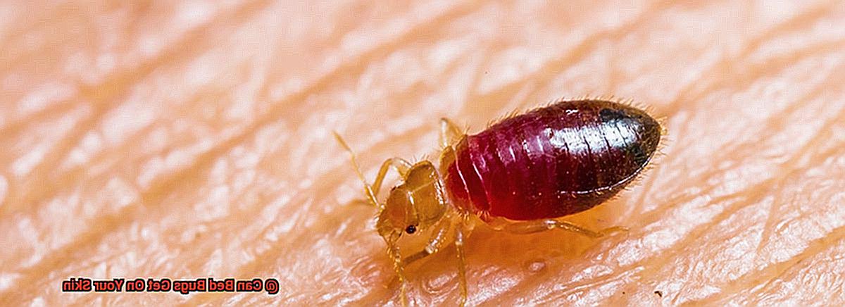 Can Bed Bugs Get On Your Skin-5