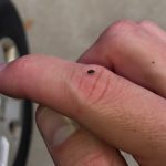 Carpet Beetle Larvae In Car